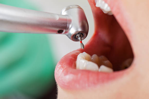 Best Mobile Emergency Dentist in Chelsea, MI